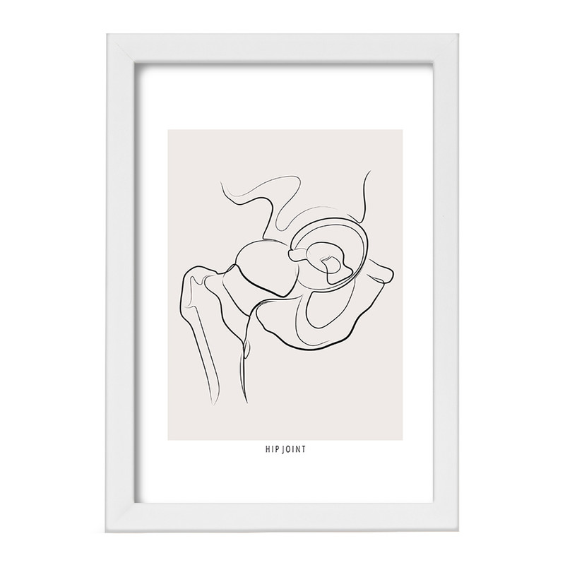 تابلو خندالو طرح مفصل ران (Hip Joint) کد F13913