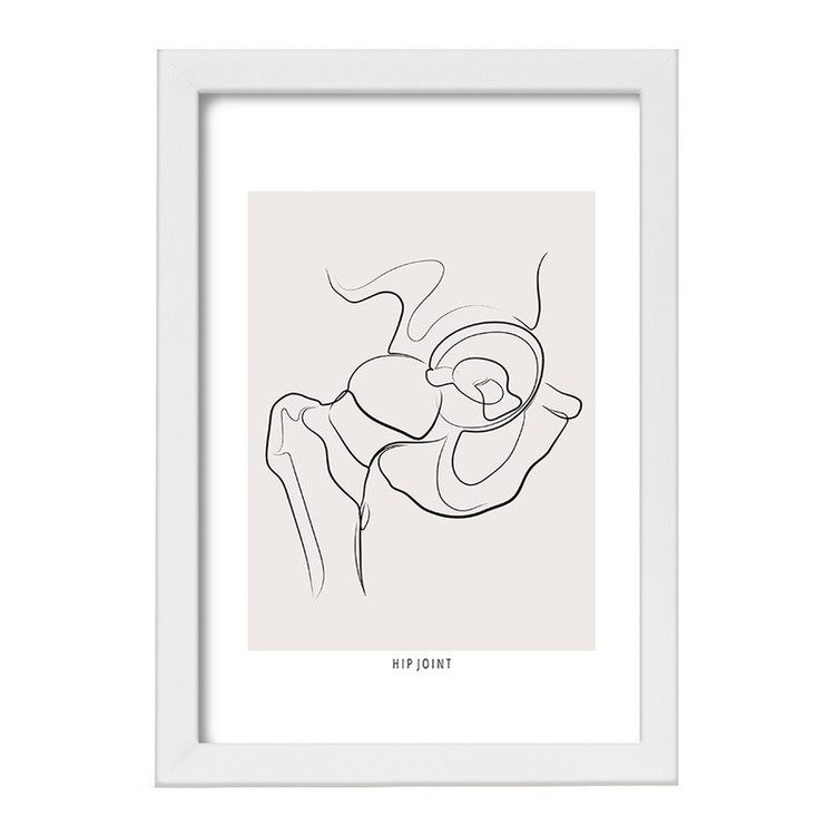 تابلو خندالو طرح مفصل ران (Hip Joint) کد F13913