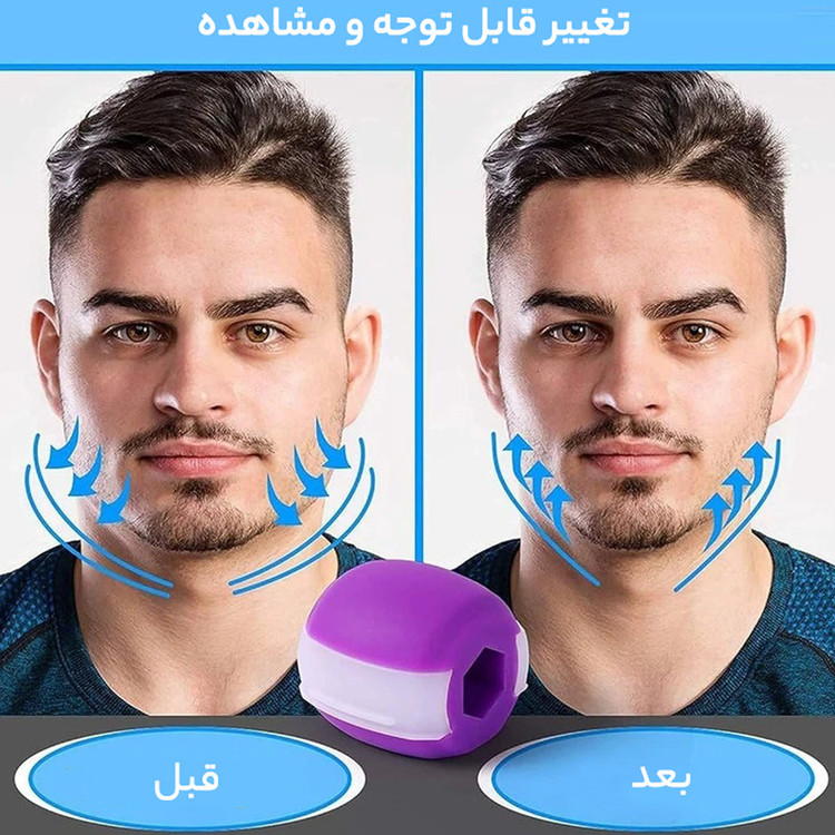 دستگاه زاویه ساز و تقویت فک مدل JW-PRO