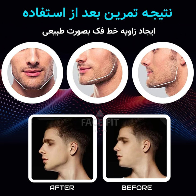 دستگاه زاویه ساز فک مدل 3Level بسته 6 عددی